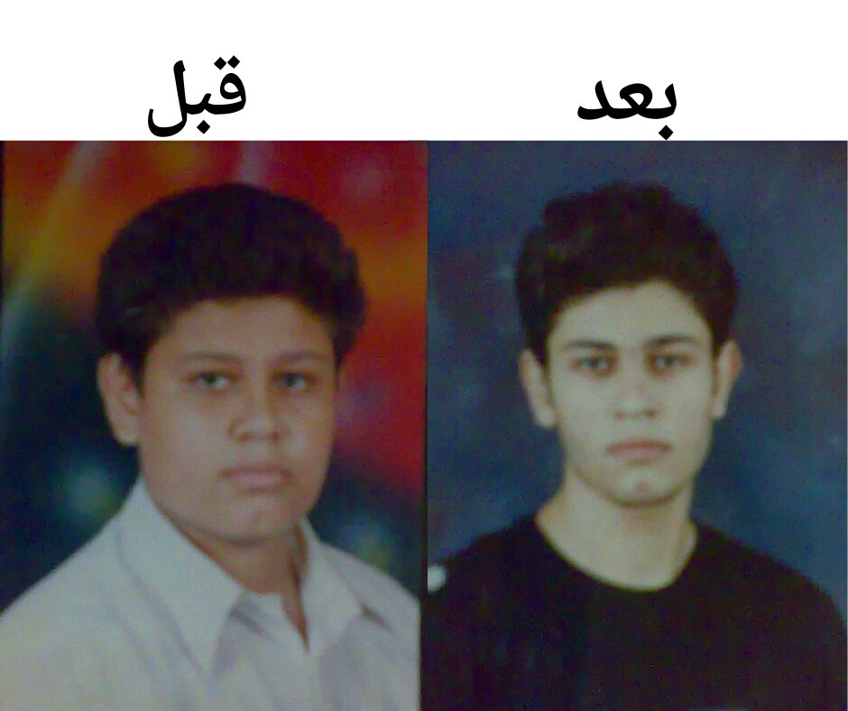 صورة توضح الفرق في الوزن قبل وبعد